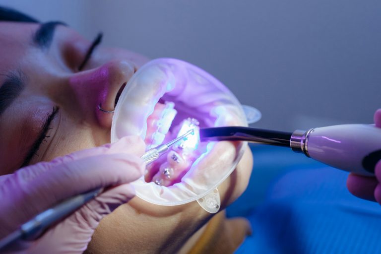 Dental Braces in Stoney Creek